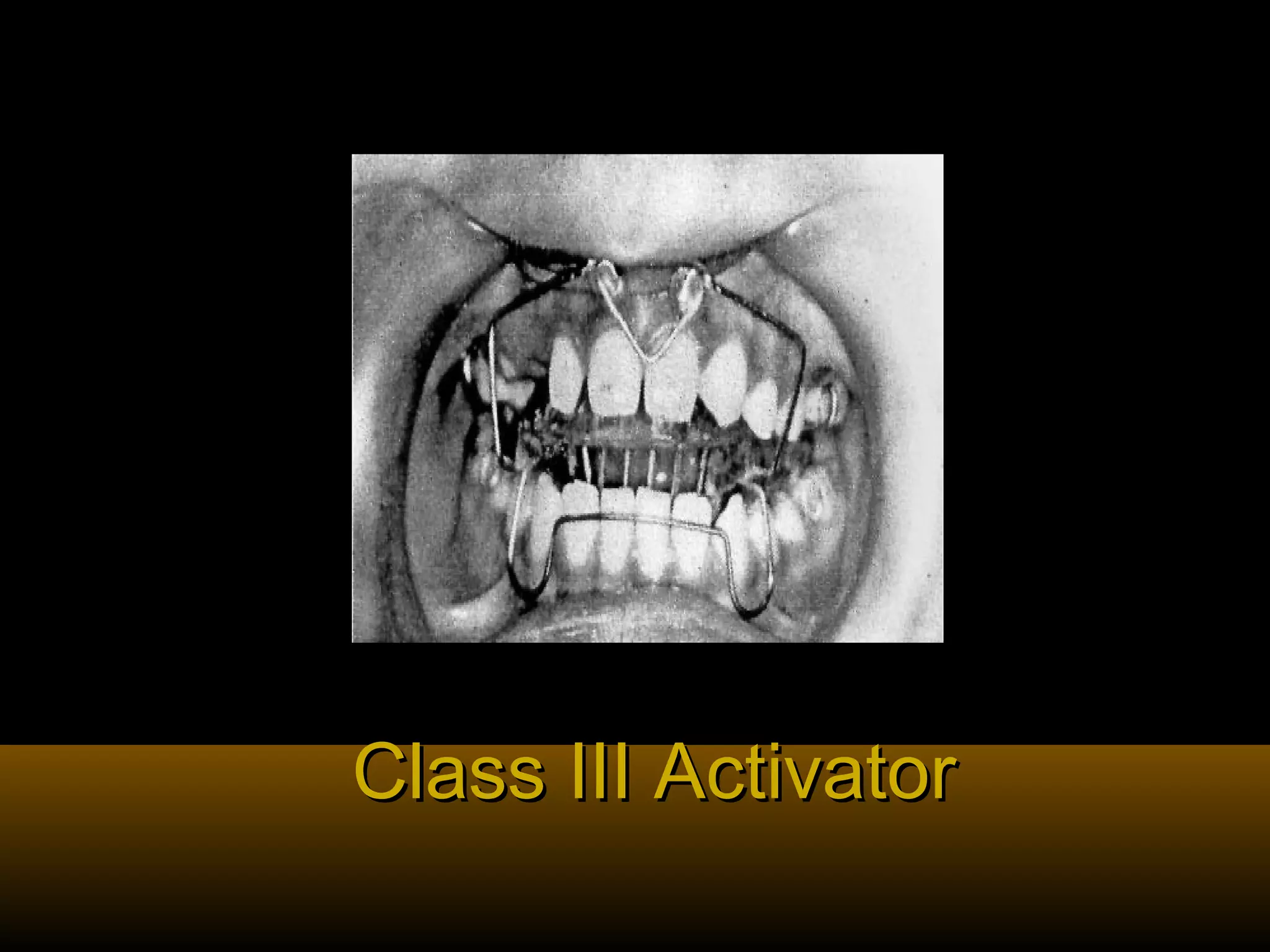 Class III ActivatorClass III Activator
 