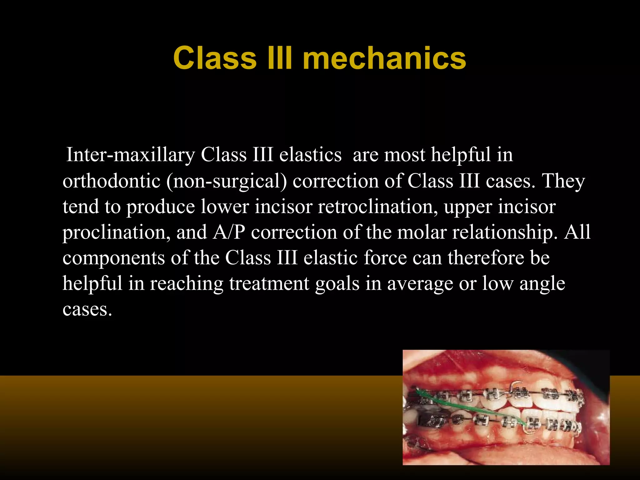 Class III mechanicsClass III mechanics
Inter-maxillary Class III elastics are most helpful in
orthodontic (non-surgical) correction of Class III cases. They
tend to produce lower incisor retroclination, upper incisor
proclination, and A/P correction of the molar relationship. All
components of the Class III elastic force can therefore be
helpful in reaching treatment goals in average or low angle
cases.
 