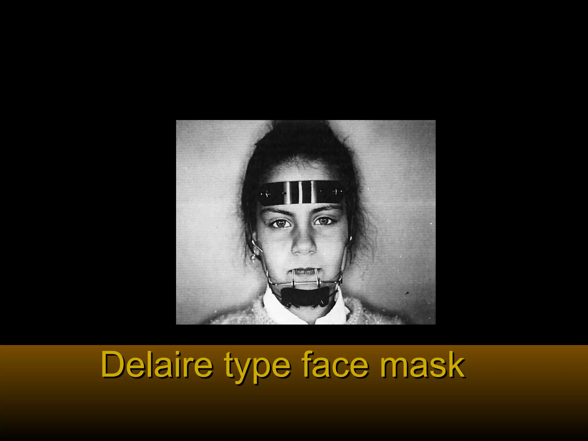 Delaire type face maskDelaire type face mask
 