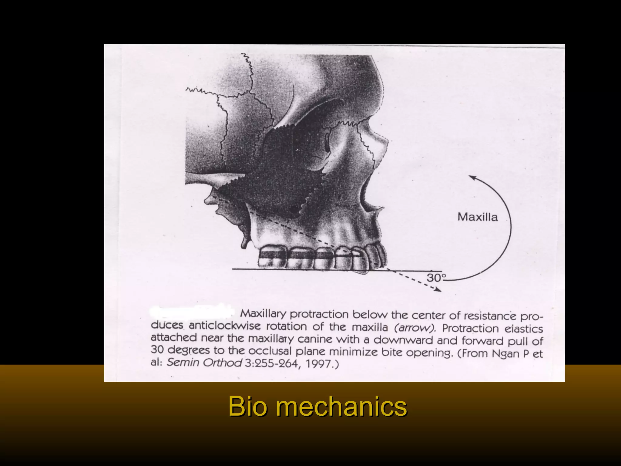 Bio mechanicsBio mechanics
 