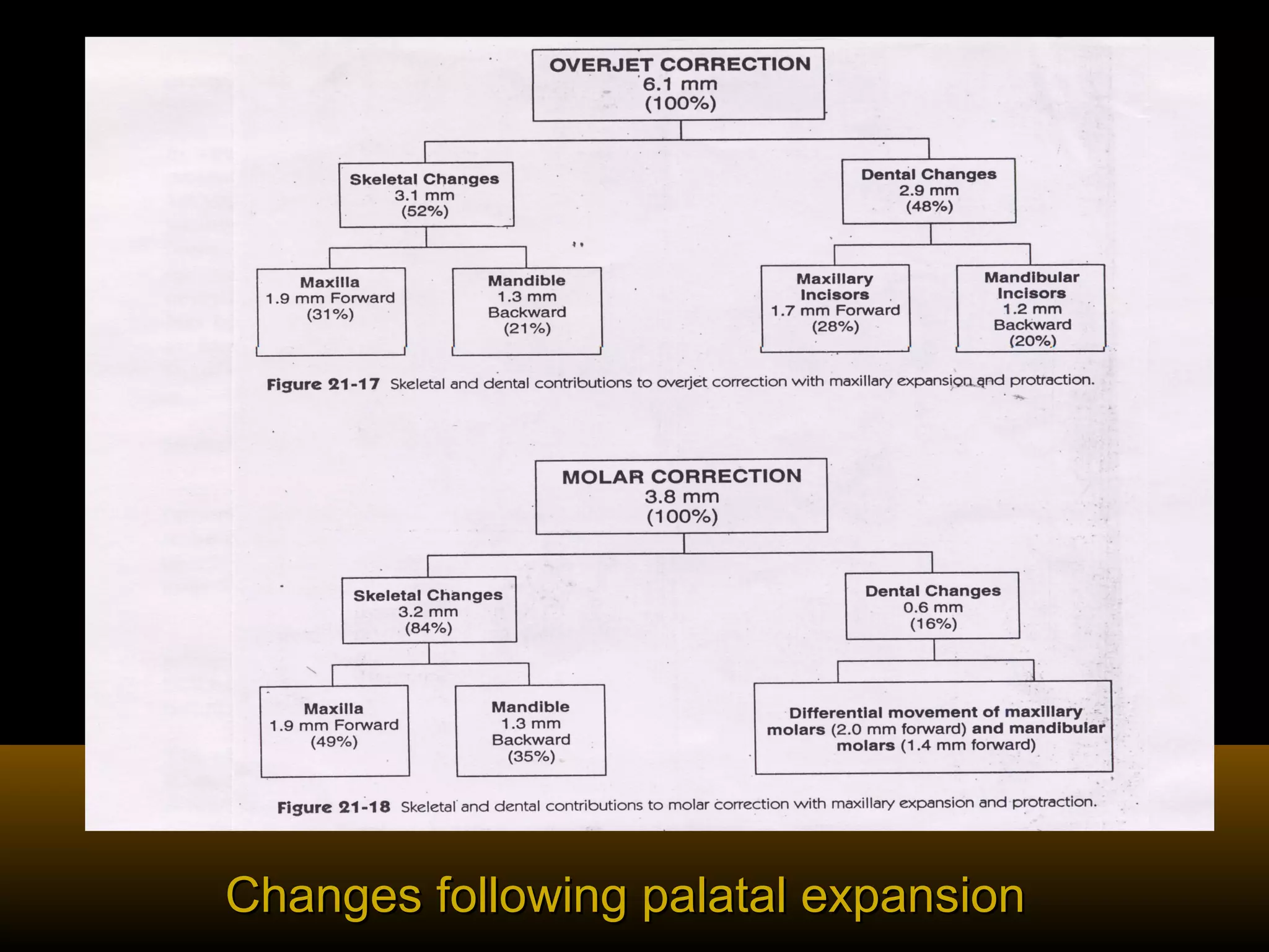 Changes following palatal expansionChanges following palatal expansion
 