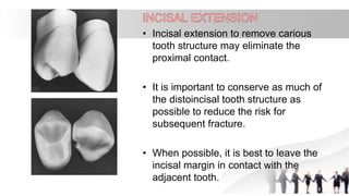 • Incisal extension to remove carious
tooth structure may eliminate the
proximal contact.
• It is important to conserve as much of
the distoincisal tooth structure as
possible to reduce the risk for
subsequent fracture.
• When possible, it is best to leave the
incisal margin in contact with the
adjacent tooth.
 