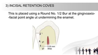 3) INCISAL RETENTION COVES
This is placed using a Round No. 1/2 Bur at the gingivoaxio-
-facial point angle ut undermining the enamel.
 