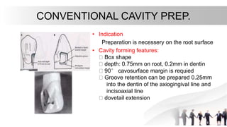 CONVENTIONAL CAVITY PREP.
• Indication
Preparation is necessery on the root surface
• Cavity forming features:
Box shape
depth: 0.75mm on root, 0.2mm in dentin
90° cavosurface margin is requied
Groove retention can be prepared 0.25mm
into the dentin of the axiogingival line and
incisoaxial line
dovetail extension
 