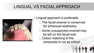 LINGUAL VS FACIAL APPROACH
• Lingual approach is preferable
The facial enamel is conserved
for enhanced aesthetics.
Some unsupported enamel may
be left on the facial wall
Colour matching of the
composite is not as critical
 