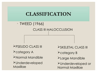 Comprehensive Overview of Class III Malocclusion: Etiology, Diagnosis ...