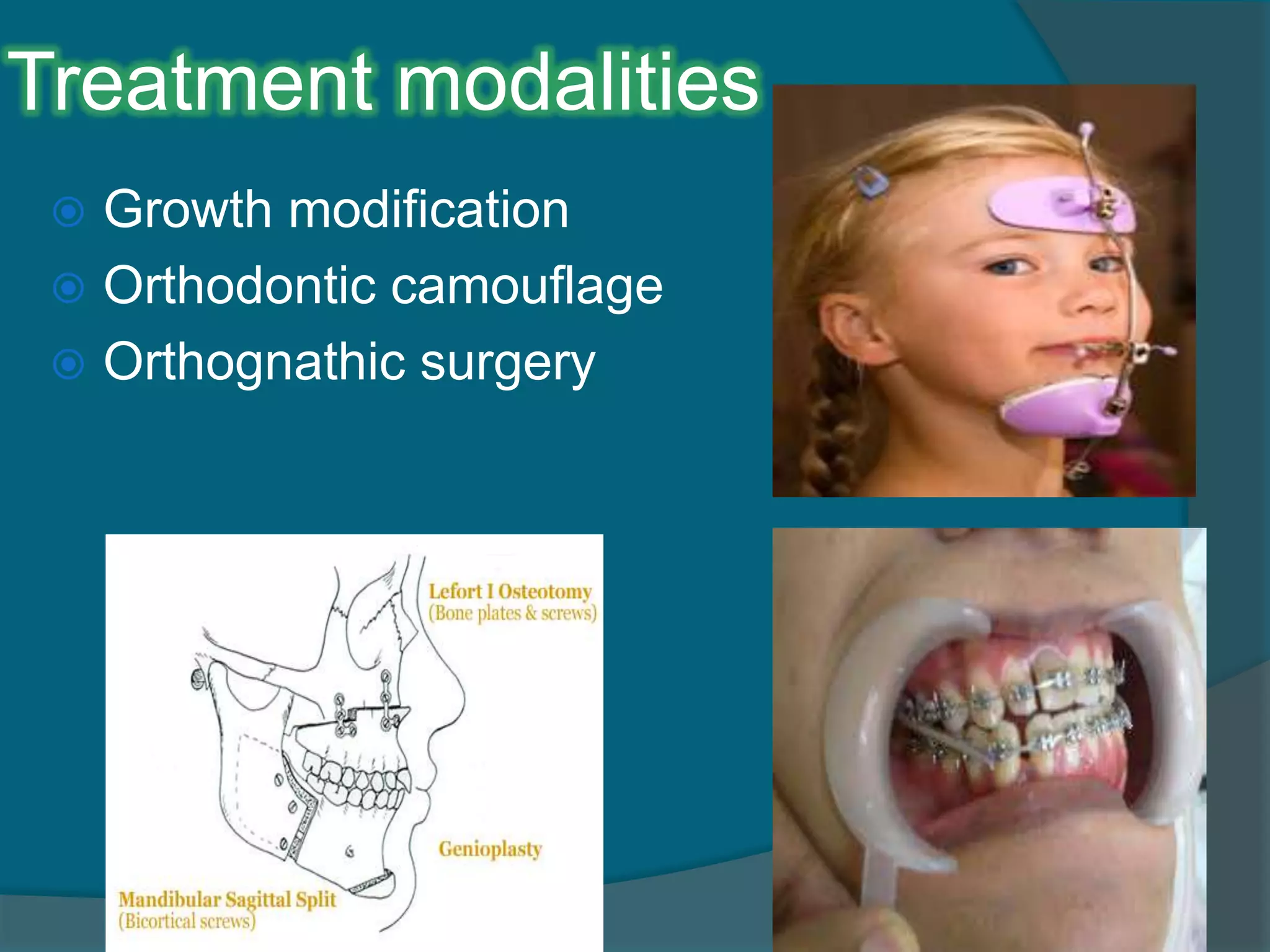 Treatment modalities
 Growth modification
 Orthodontic camouflage
 Orthognathic surgery
 