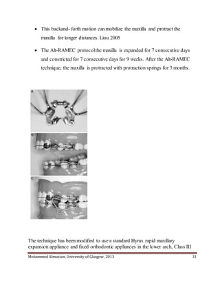 Mohammed Almuzian, University of Glasgow, 2013 31
 This backand- forth motion can mobilize the maxilla and protract the
maxilla for longer distances. Liou 2005
 The Alt-RAMEC protocolthe maxilla is expanded for 7 consecutive days
and constricted for 7 consecutive days for 9 weeks. After the Alt-RAMEC
technique, the maxilla is protracted with protraction springs for 3 months.
The technique has been modified to use a standard Hyrax rapid maxillary
expansion appliance and fixed orthodontic appliances in the lower arch, Class III
 