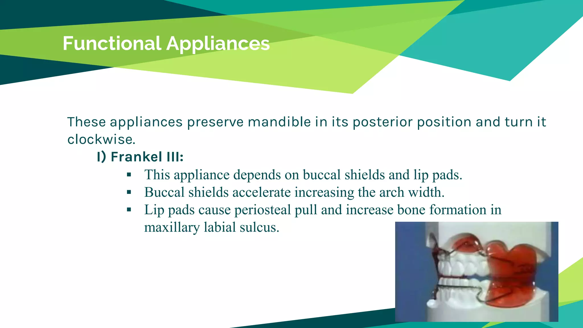 Functional Appliances
These appliances preserve mandible in its posterior position and turn it
clockwise.
I) Frankel III:
 This appliance depends on buccal shields and lip pads.
 Buccal shields accelerate increasing the arch width.
 Lip pads cause periosteal pull and increase bone formation in
maxillary labial sulcus.
 