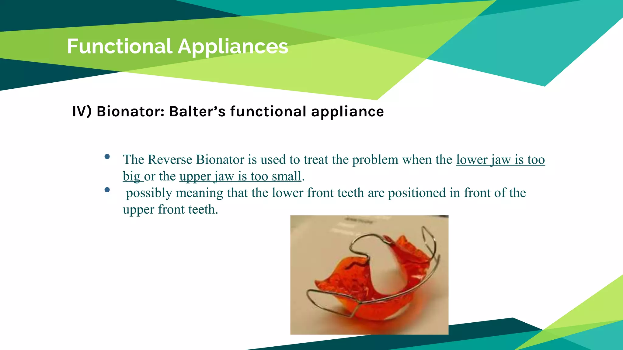 Functional Appliances
IV) Bionator: Balter’s functional appliance
• The Reverse Bionator is used to treat the problem when the lower jaw is too
big or the upper jaw is too small.
• possibly meaning that the lower front teeth are positioned in front of the
upper front teeth.
 