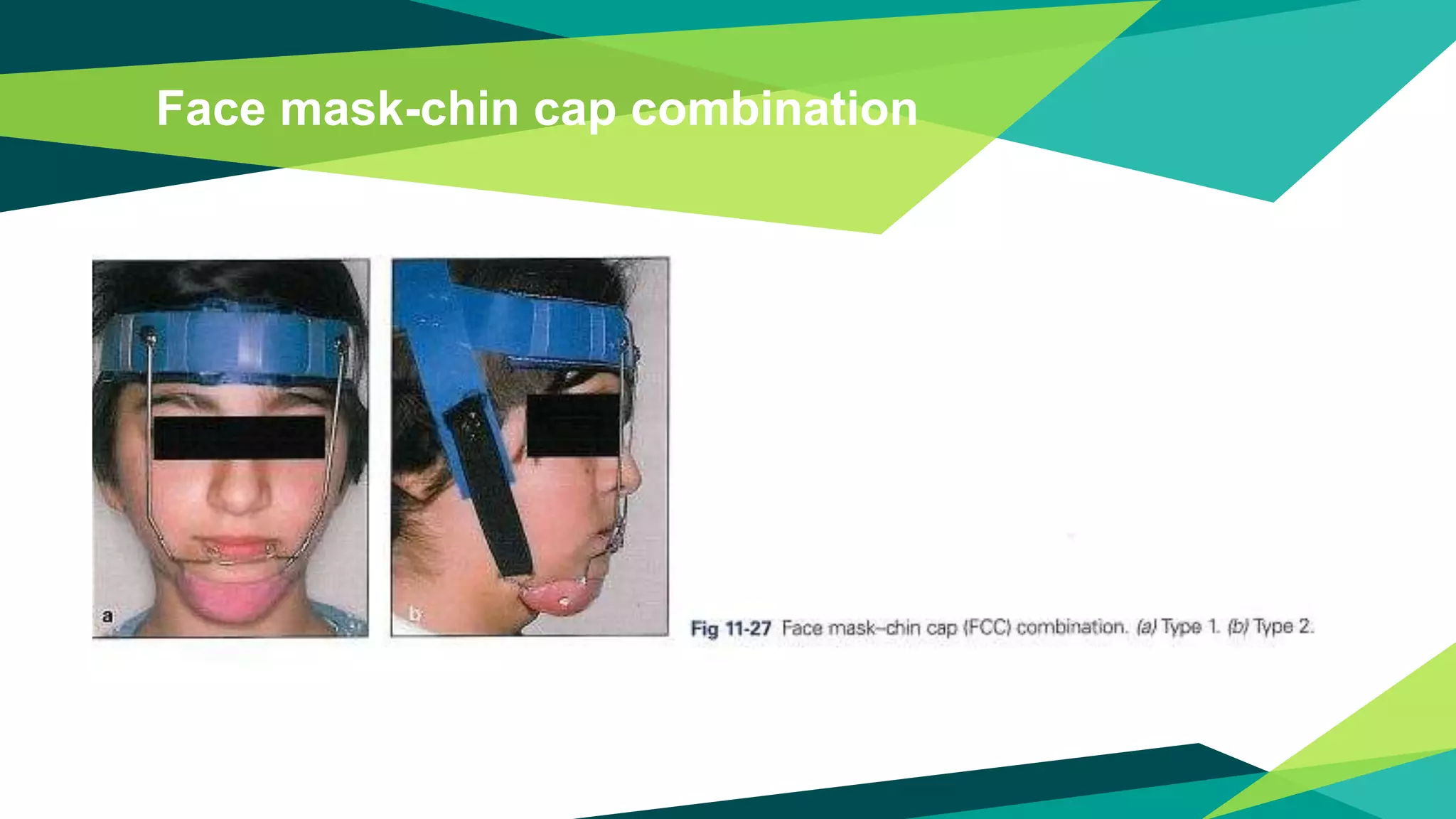 Face mask-chin cap combination
 