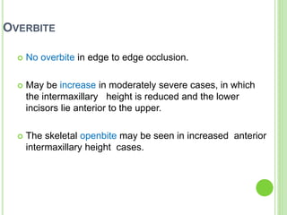 OVERBITE
 No overbite in edge to edge occlusion.
 May be increase in moderately severe cases, in which
the intermaxillary height is reduced and the lower
incisors lie anterior to the upper.
 The skeletal openbite may be seen in increased anterior
intermaxillary height cases.
 