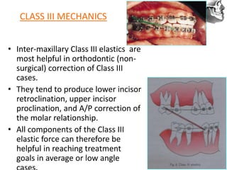 VT’s
CLASS III MECHANICS
• Inter-maxillary Class III elastics are
most helpful in orthodontic (non-
surgical) correction of Class III
cases.
• They tend to produce lower incisor
retroclination, upper incisor
proclination, and A/P correction of
the molar relationship.
• All components of the Class III
elastic force can therefore be
helpful in reaching treatment
goals in average or low angle
 