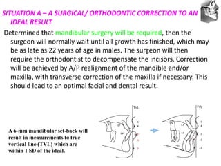 VT’s
SITUATION A – A SURGICAL/ ORTHODONTIC CORRECTION TO AN
IDEAL RESULT
Determined that mandibular surgery will be required, then the
surgeon will normally wait until all growth has finished, which may
be as late as 22 years of age in males. The surgeon will then
require the orthodontist to decompensate the incisors. Correction
will be achieved by A/P realignment of the mandible and/or
maxilla, with transverse correction of the maxilla if necessary. This
should lead to an optimal facial and dental result.
A 6-mm mandibular set-back will
result in measurements to true
vertical line (TVL) which are
within 1 SD of the ideal.
 