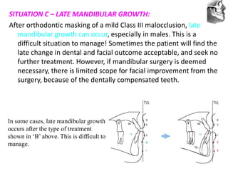 VT’s
SITUATION C – LATE MANDIBULAR GROWTH:
After orthodontic masking of a mild Class III malocclusion, late
mandibular growth can occur, especially in males. This is a
difficult situation to manage! Sometimes the patient will find the
late change in dental and facial outcome acceptable, and seek no
further treatment. However, if mandibular surgery is deemed
necessary, there is limited scope for facial improvement from the
surgery, because of the dentally compensated teeth.
In some cases, late mandibular growth
occurs after the type of treatment
shown in ‘B’ above. This is difficult to
manage.
 