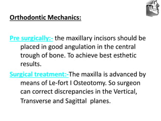VT’s
Orthodontic Mechanics:
Pre surgically:- the maxillary incisors should be
placed in good angulation in the central
trough of bone. To achieve best esthetic
results.
Surgical treatment:-The maxilla is advanced by
means of Le-fort I Osteotomy. So surgeon
can correct discrepancies in the Vertical,
Transverse and Sagittal planes.
 