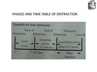 VT’s
PHASES AND TIME TABLE OF DISTRACTION
 