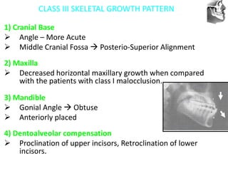VT’s
CLASS III SKELETAL GROWTH PATTERN
1) Cranial Base
 Angle – More Acute
 Middle Cranial Fossa  Posterio-Superior Alignment
2) Maxilla
 Decreased horizontal maxillary growth when compared
with the patients with class I malocclusion.
3) Mandible
 Gonial Angle  Obtuse
 Anteriorly placed
4) Dentoalveolar compensation
 Proclination of upper incisors, Retroclination of lower
incisors.
 