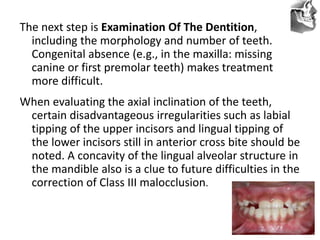 VT’s
The next step is Examination Of The Dentition,
including the morphology and number of teeth.
Congenital absence (e.g., in the maxilla: missing
canine or first premolar teeth) makes treatment
more difficult.
When evaluating the axial inclination of the teeth,
certain disadvantageous irregularities such as labial
tipping of the upper incisors and lingual tipping of
the lower incisors still in anterior cross bite should be
noted. A concavity of the lingual alveolar structure in
the mandible also is a clue to future difficulties in the
correction of Class III malocclusion.
 