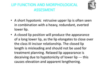 VT’s
LIP FUNCTION AND MORPHOLOGICAL
ASSESMENT
• A short hypotonic retrusive upper lip is often seen
in combination with a heavy, redundant, everted
lower lip.
• A closed lip position will produce the appearance
of a long lower lip, as the lip elongates to close over
the class III incisor relationship. The closed lip
length is misleading and should not be used for
treatment planning. Relaxed lip appearance is
deceiving due to hypotonicity of lower lip --- this
causes elevation and apparent lengthening.
 