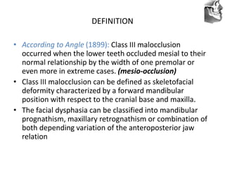 VT’s
DEFINITION
• According to Angle (1899): Class III malocclusion
occurred when the lower teeth occluded mesial to their
normal relationship by the width of one premolar or
even more in extreme cases. (mesio-occlusion)
• Class III malocclusion can be defined as skeletofacial
deformity characterized by a forward mandibular
position with respect to the cranial base and maxilla.
• The facial dysphasia can be classified into mandibular
prognathism, maxillary retrognathism or combination of
both depending variation of the anteroposterior jaw
relation
 