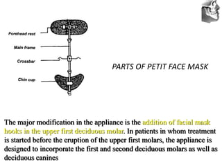 VT’s
PARTS OF PETIT FACE MASK
The major modification in the appliance is the addition of facial mask
hooks in the upper first deciduous molar. In patients in whom treatment
is started before the eruption of the upper first molars, the appliance is
designed to incorporate the first and second deciduous molars as well as
deciduous canines
 