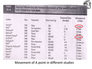 VT’s
Movement of A point in different studies
 