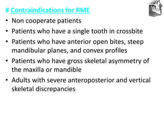 VT’s
# Contraindications for RME
• Non cooperate patients
• Patients who have a single tooth in crossbite
• Patients who have anterior open bites, steep
mandibular planes, and convex profiles
• Patients who have gross skeletal asymmetry of
the maxilla or mandible
• Adults with severe anteroposterior and vertical
skeletal discrepancies
 