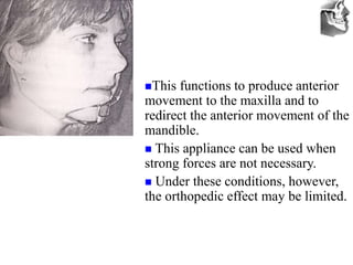 VT’s
This functions to produce anterior
movement to the maxilla and to
redirect the anterior movement of the
mandible.
 This appliance can be used when
strong forces are not necessary.
 Under these conditions, however,
the orthopedic effect may be limited.
 