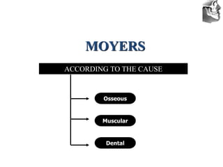 VT’s
MOYERS
ACCORDING TO THE CAUSE
Osseous
Muscular
Dental
 