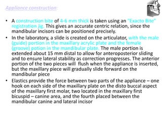 VT’s
Appliance construction:
• A construction bite of 4-6 mm thick is taken using an “Exacto Bite”
registration jig. This gives an accurate centric relation, since the
mandibular incisors can be positioned precisely.
• In the laboratory, a slide is created on the articulator, with the male
(guide) portion in the maxillary acrylic plate and the female
(groove) potion in the mandibular plate. The male portion is
extended about 15 mm distal to allow for anteroposterior sliding
and to ensure lateral stability as correction progresses. The anterior
portion of the two pieces will flush when the appliance is inserted,
but the maxillary piece will gradually slide forward on the
mandibular piece
• Elastics provide the force between two parts of the appliance – one
hook on each side of the maxillary plate on the disto buccal aspect
of the maxillary first molar, two located in the maxillary first
bicuspid – canine area, and the fourth placed between the
mandibular canine and lateral incisor
 