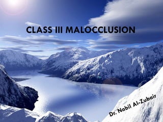 CLASS III MALOCCLUSION
 