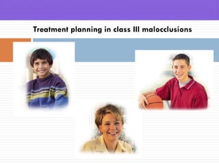 Treatment planning in class III malocclusions
 