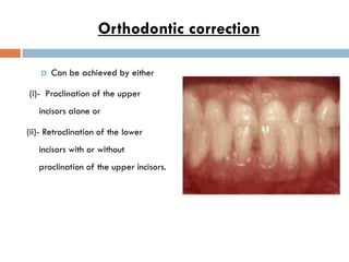 Orthodontic correction

      Can be achieved by either

(i)- Proclination of the upper
   incisors alone or

(ii)- Retro...