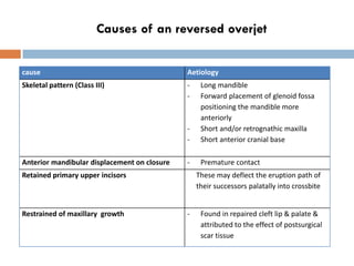 Causes of an reversed overjet


cause                                         Aetiology
Skeletal pattern (Class III)      ...