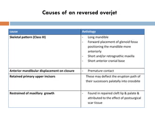 class iii malocclusion slideshare