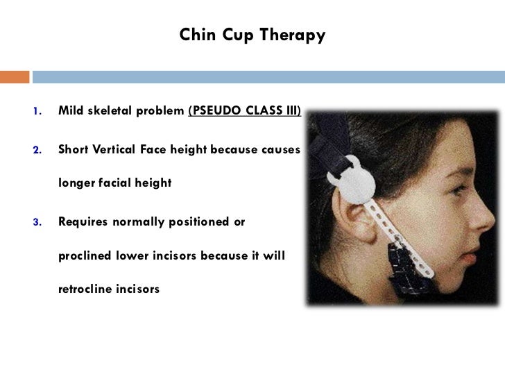 Class III Malocclusion Dr. Nabil AlZubair