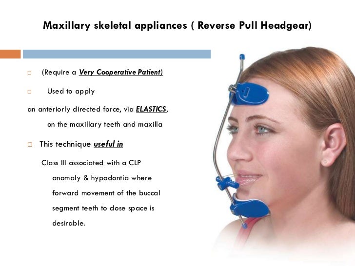 Class III Malocclusion Dr. Nabil AlZubair