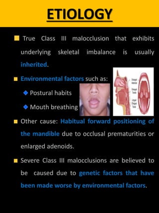 ETIOLOGY
True Class III malocclusion that exhibits
underlying skeletal imbalance is usually
inherited.
Environmental factors such as:
Postural habits
Mouth breathing
Other cause: Habitual forward positioning of
the mandible due to occlusal prematurities or
enlarged adenoids.
Severe Class III malocclusions are believed to
be caused due to genetic factors that have
been made worse by environmental factors.
 