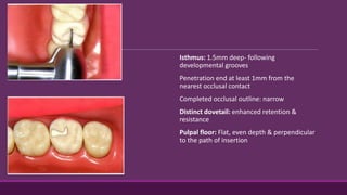 Isthmus: 1.5mm deep- following
developmental grooves
Penetration end at least 1mm from the
nearest occlusal contact
Completed occlusal outline: narrow
Distinct dovetail: enhanced retention &
resistance
Pulpal floor: Flat, even depth & perpendicular
to the path of insertion
 