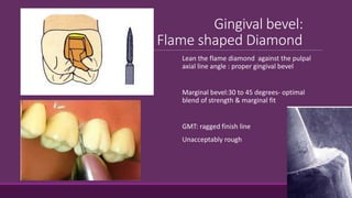 Gingival bevel:
Flame shaped Diamond
Lean the flame diamond against the pulpal
axial line angle : proper gingival bevel
Marginal bevel:30 to 45 degrees- optimal
blend of strength & marginal fit
GMT: ragged finish line
Unacceptably rough
 