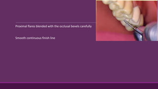 Proximal flares blended with the occlusal bevels carefully
Smooth continuous finish line
 
