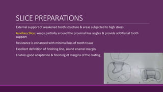 SLICE PREPARATIONS
External support of weakened tooth structure & areas subjected to high stress
Auxiliary Slice: wraps partially around the proximal line angles & provide additional tooth
support
Resistance is enhanced with minimal loss of tooth tissue
Excellent definition of finishing line, sound enamel margin
Enables good adaptation & finishing of margins of the casting
 