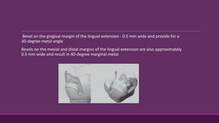 Bevel on the gingival margin of the lingual extension - 0.5 mm wide and provide for a
30-degree metal angle
Bevels on the mesial and distal margins of the lingual extension are also approximately
0.5 mm wide and result in 40-degree marginal metal
 