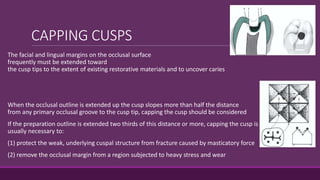 CAPPING CUSPS
The facial and lingual margins on the occlusal surface
frequently must be extended toward
the cusp tips to the extent of existing restorative materials and to uncover caries
When the occlusal outline is extended up the cusp slopes more than half the distance
from any primary occlusal groove to the cusp tip, capping the cusp should be considered
If the preparation outline is extended two thirds of this distance or more, capping the cusp is
usually necessary to:
(1) protect the weak, underlying cuspal structure from fracture caused by masticatory force
(2) remove the occlusal margin from a region subjected to heavy stress and wear
 