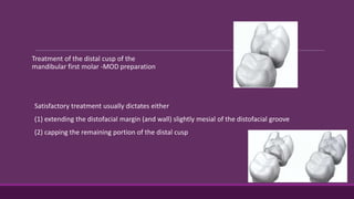 Treatment of the distal cusp of the
mandibular first molar -MOD preparation
Satisfactory treatment usually dictates either
(1) extending the distofacial margin (and wall) slightly mesial of the distofacial groove
(2) capping the remaining portion of the distal cusp
 