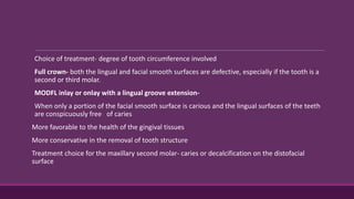Choice of treatment- degree of tooth circumference involved
Full crown- both the lingual and facial smooth surfaces are defective, especially if the tooth is a
second or third molar.
MODFL inlay or onlay with a lingual groove extension-
When only a portion of the facial smooth surface is carious and the lingual surfaces of the teeth
are conspicuously free of caries
More favorable to the health of the gingival tissues
More conservative in the removal of tooth structure
Treatment choice for the maxillary second molar- caries or decalcification on the distofacial
surface
 