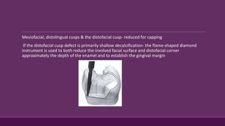 Mesiofacial, distolingual cusps & the distofacial cusp- reduced for capping
If the distofacial cusp defect is primarily shallow decalcification- the flame-shaped diamond
instrument is used to both reduce the involved facial surface and distofacial corner
approximately the depth of the enamel and to establish the gingival margin
 