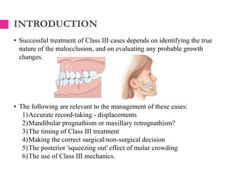 Class III treatment mbt | PPTX