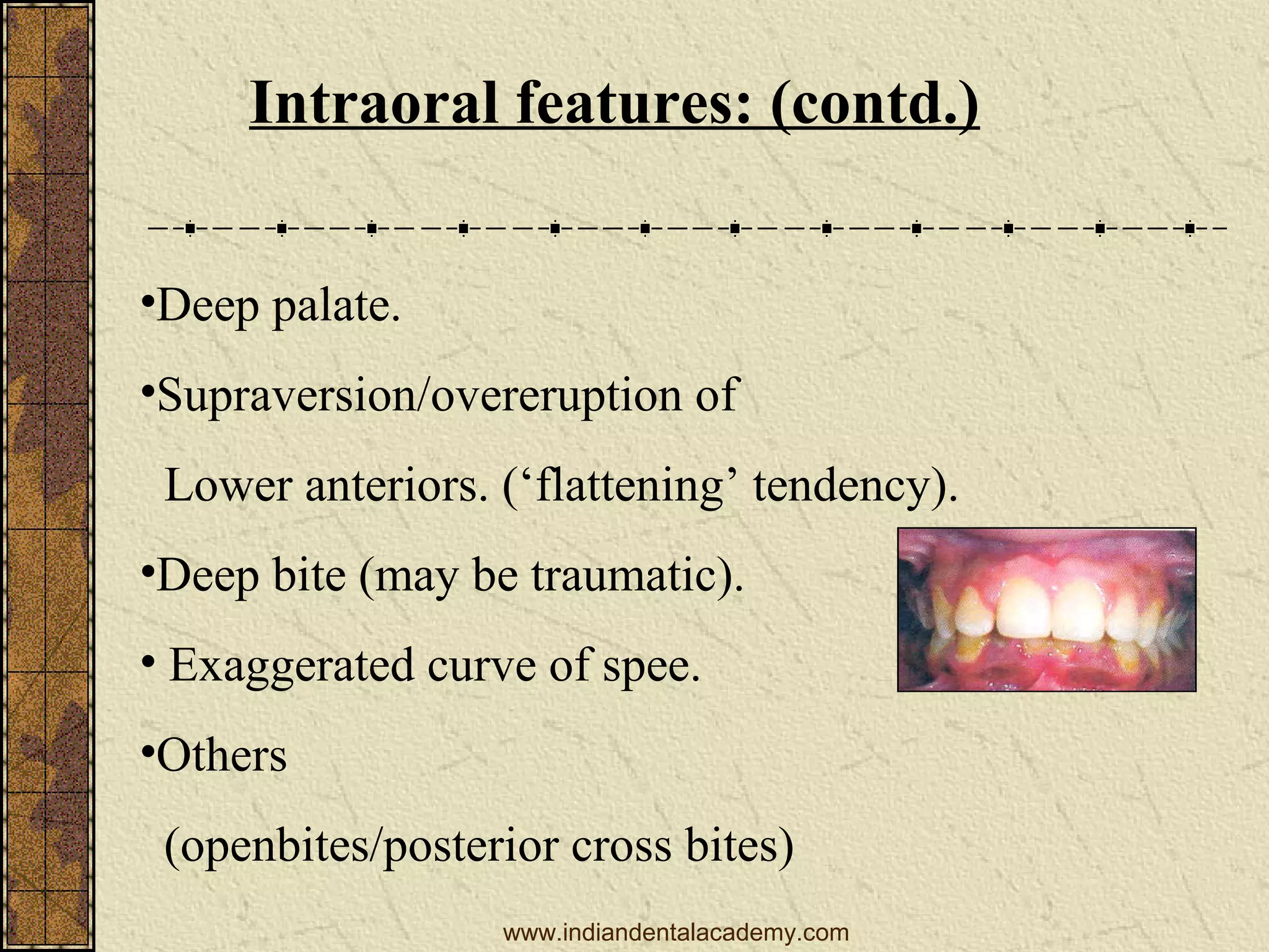 Intraoral features: (contd.)
•Deep palate.
•Supraversion/overeruption of
Lower anteriors. (‘flattening’ tendency).
•Deep bite (may be traumatic).
• Exaggerated curve of spee.
•Others
(openbites/posterior cross bites)
www.indiandentalacademy.com

 